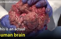 The Actual Unfixed Human Brain