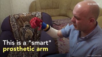 A Smart Prosthetic 3D Printed Arm