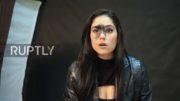 Brazilian Model Mariana Mendes Says Large Facial Birthmark Hasn’t Held Her Back