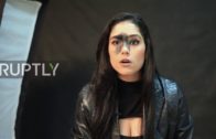 Brazilian Model Mariana Mendes Says Large Facial Birthmark Hasn’t Held Her Back