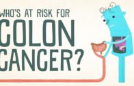 Find Out If You’re At Risk For Colon Cancer